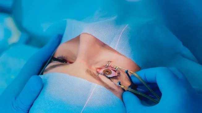 Kesehatan Rohani Pasca Operasi Korneo Mata Biar Lebih Tenang